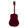 EpiPhone Starling Player Pack Hpp Paquete Guitarra Acústica Color Rosa Orientación De La Mano Derecha